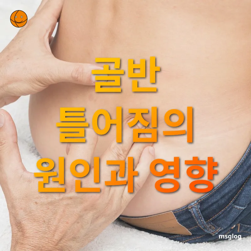 골반 정렬 - 잘못된 자세가 골반을 뒤틀게 한다 골반 정렬 잘못된 자세가 골반을 뒤틀게 한다 관련 이미지